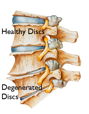 physio photo