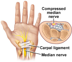 physio photo