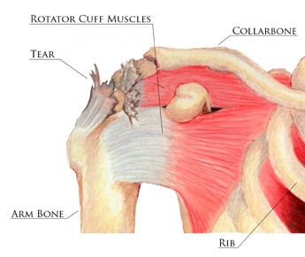 physio photo
